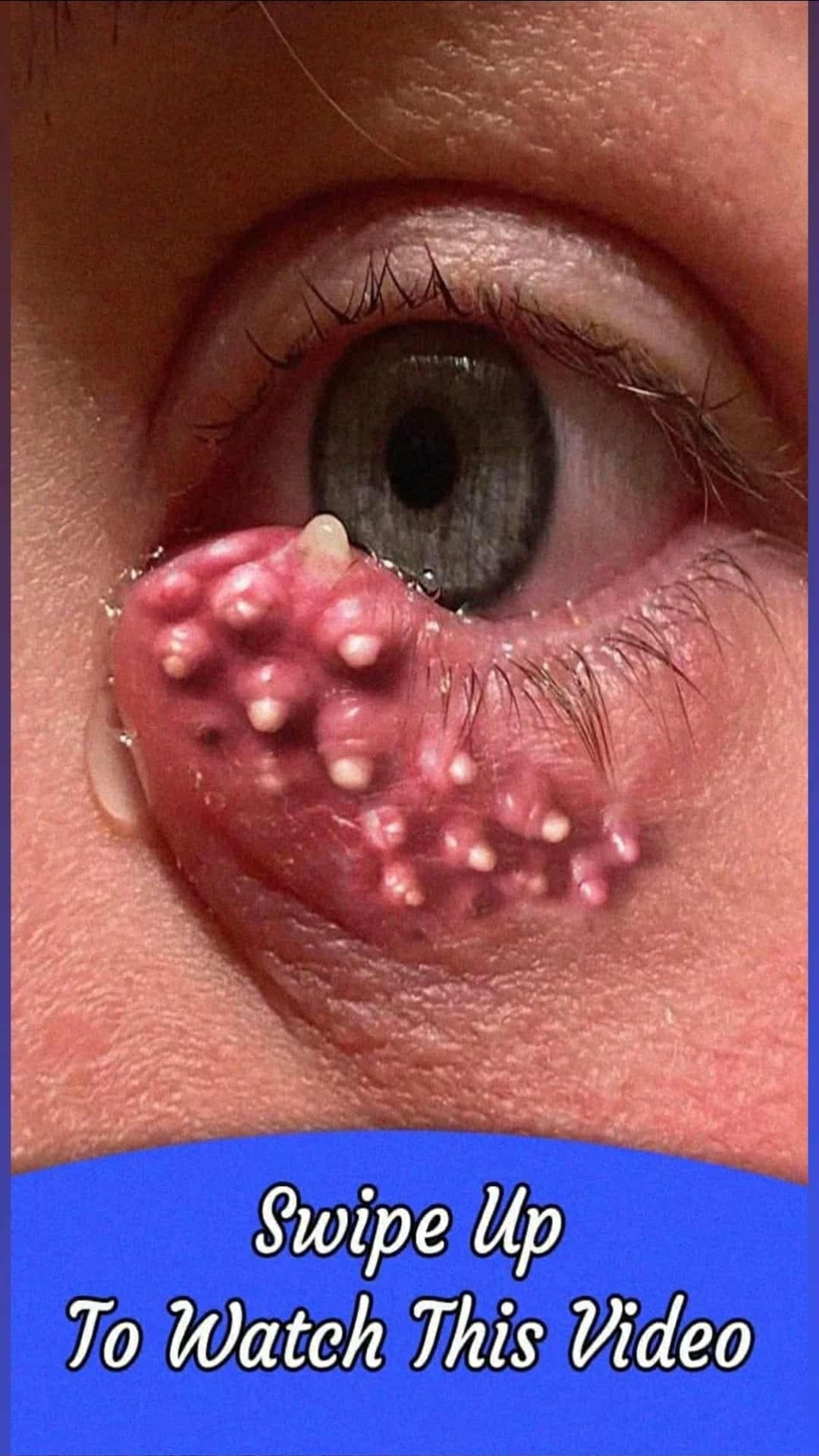 Alarming Skin Symptoms You Should Never Ignore