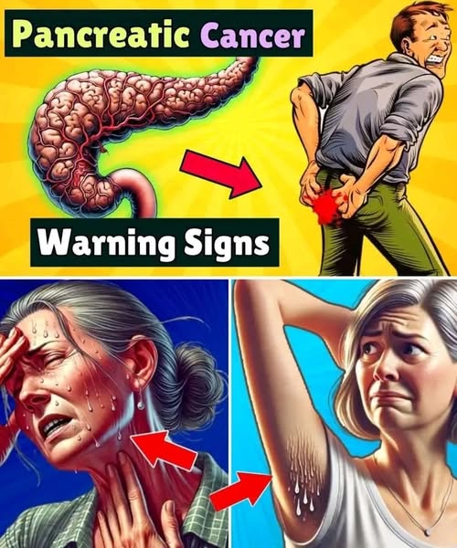 8 Shocking Signs of Pancreatic Cancer You Shouldn’t Ignore (Part 1)