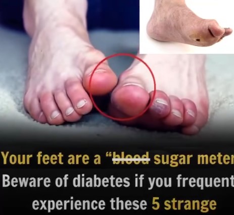 5 Subtle Foot Symptoms That Could Signal Diabetes