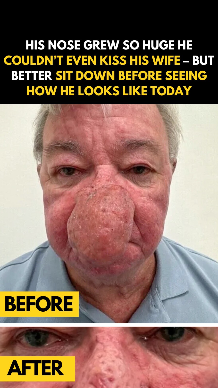 The Man Who Couldn’t Kiss His Wife