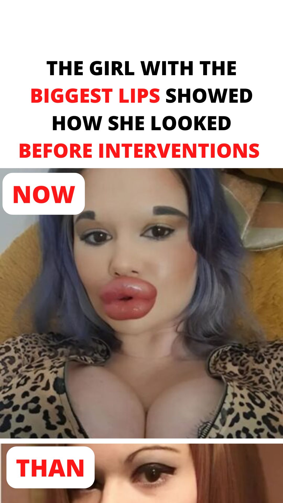 The Girl Behind the “Biggest Lips” Trend