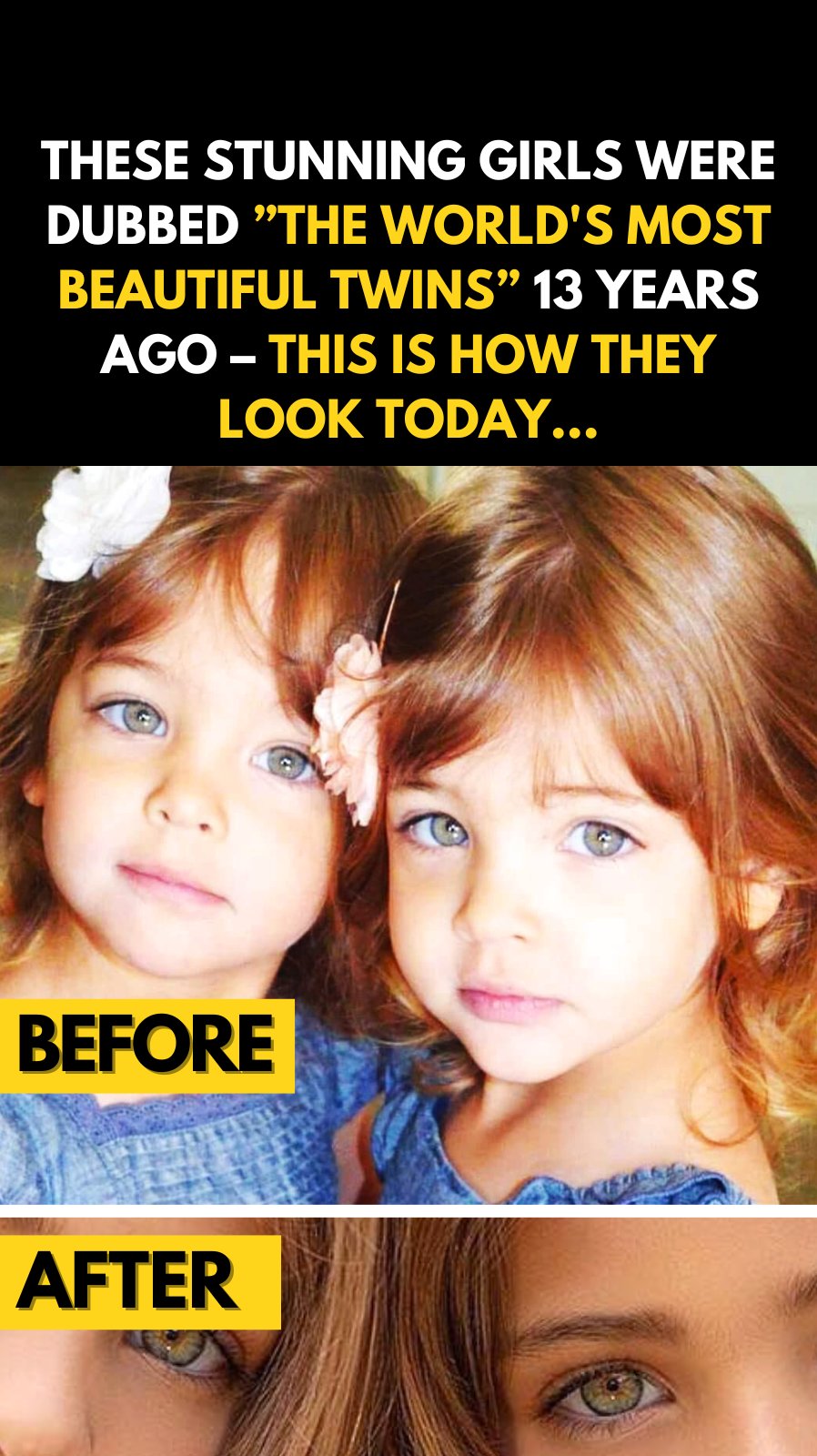 Once Called the “Most Beautiful Twins in the World” — Here’s Where They Are Now