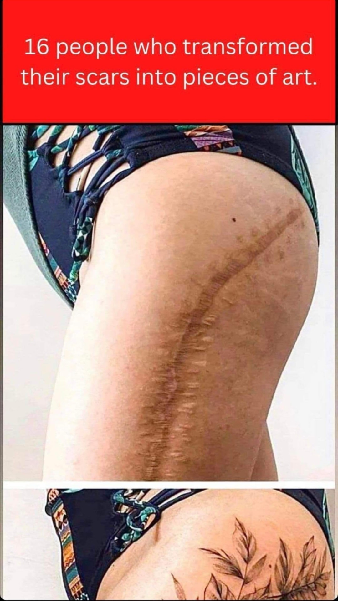 When Scars Tell a Story