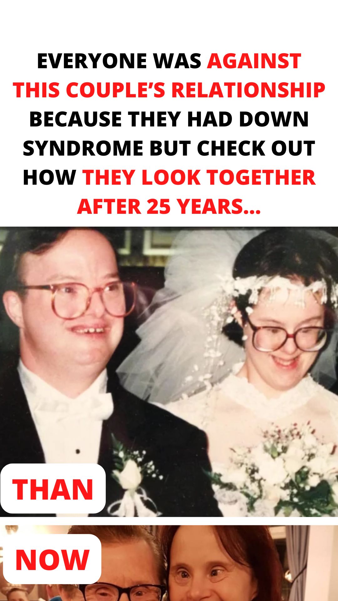 Their Love Was Doomed—But They Became Britain’s First Married Couple with Down Syndrome