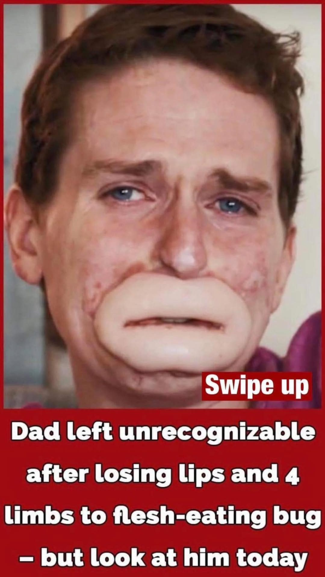 When a Simple Cold Turned Into a Nightmare