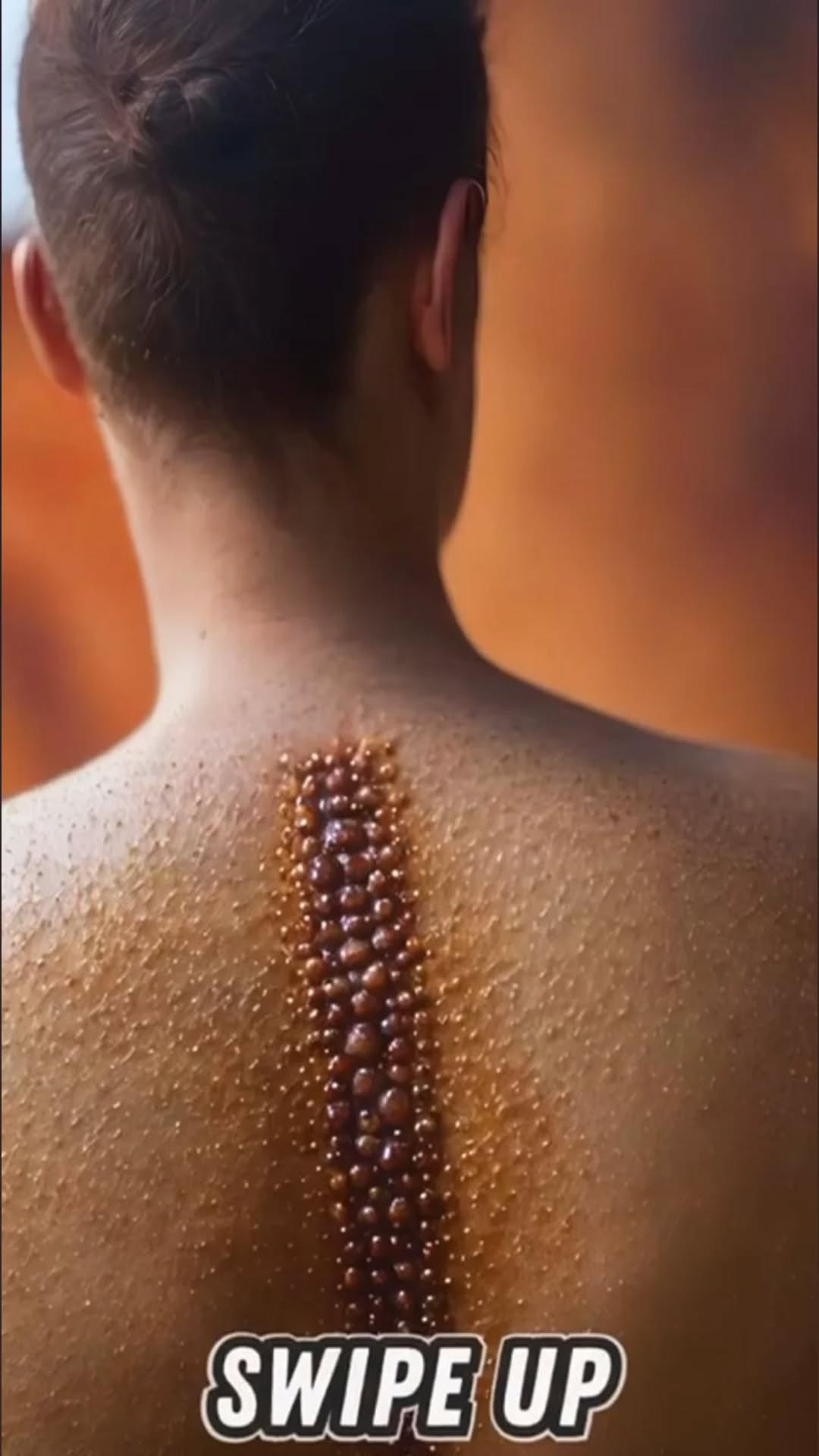 When Acne Is More Than Skin-Deep: Signs You Should See a Dermatologist