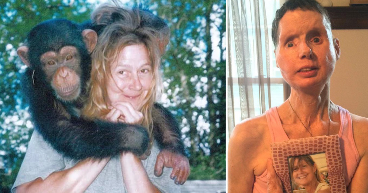 The Unthinkable Attack: How a Kind Gesture Turned Into a Life-Altering Tragedy