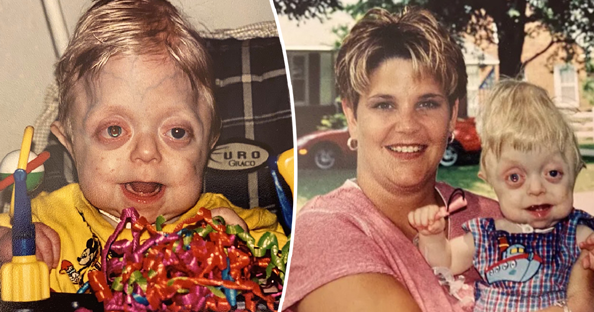 Young Man Who Defied Medical Expectations Celebrates High School Graduation and New Career