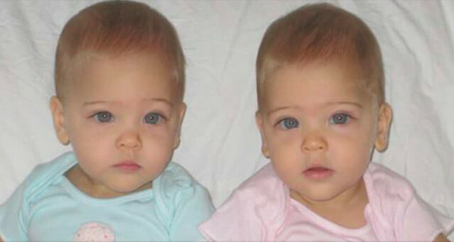 Identical Twin Sisters Who Captivated the World as Babies Reveal Their Lives as Preteens