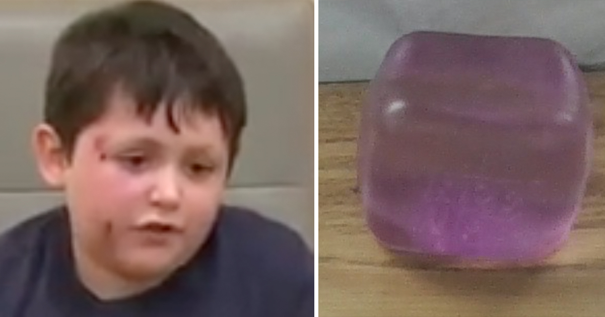 Doctors Issue Urgent Warning Over NeeDoh Cubes After Children Suffer Severe Burns