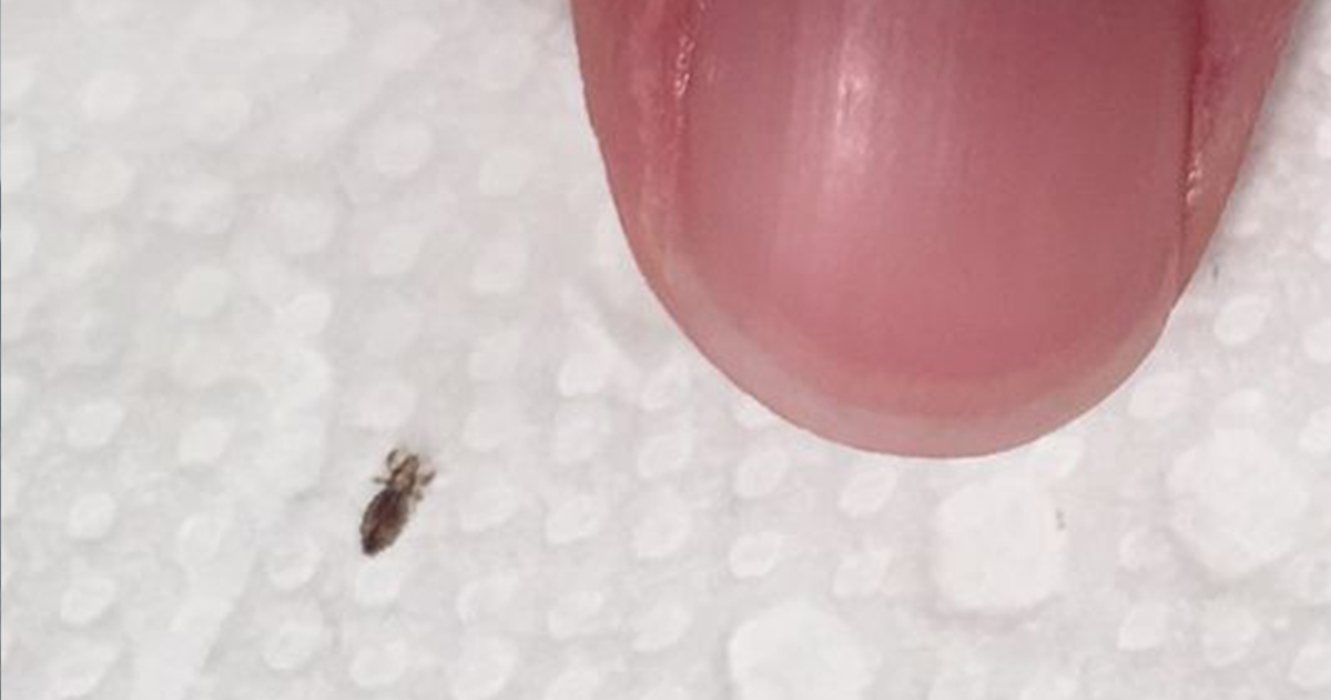 How to Spot and Eliminate Head Lice Without Harsh Chemicals